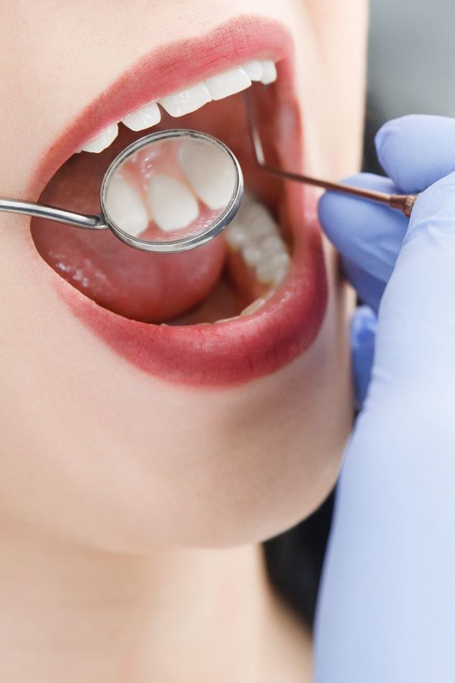 Kontrola stomatologiczna jamy ustnej.